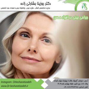 جراحی بینی در افراد مسن