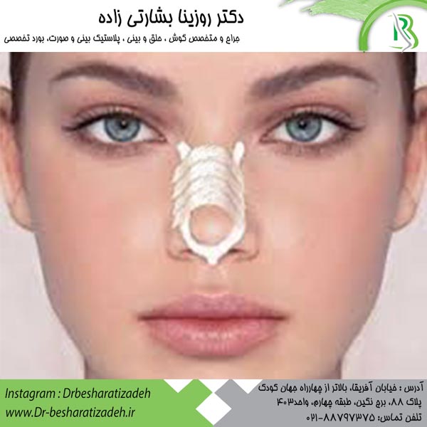 چسب زدن بینی از عمل بینی - دکتر روزینا بشارتی زاده