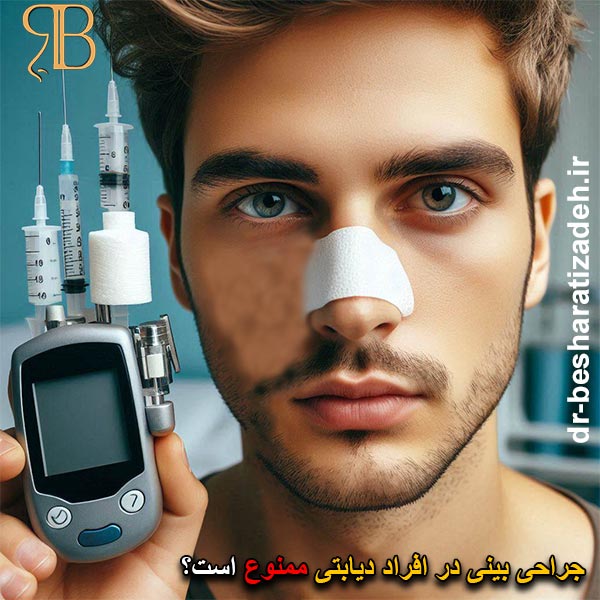 جراحی بینی در افراد دیابتی - dr-besharatizadeh.ir