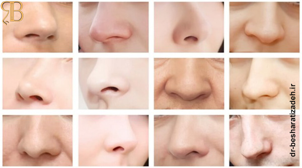 انواع مدل بینی - dr-besharatizadeh.ir