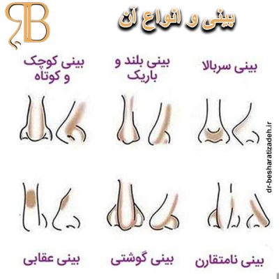 بینی و انواع آن - dr-besharatizadeh.ir