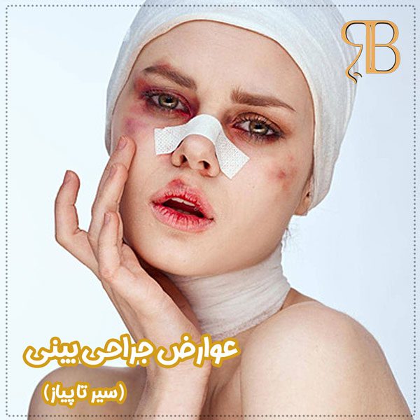 عوارض جراحی بینی - دکتر بشارتی زاده