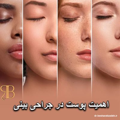 اهمیت پوست در جراحی بینی - dr-besharatizadeh.ir