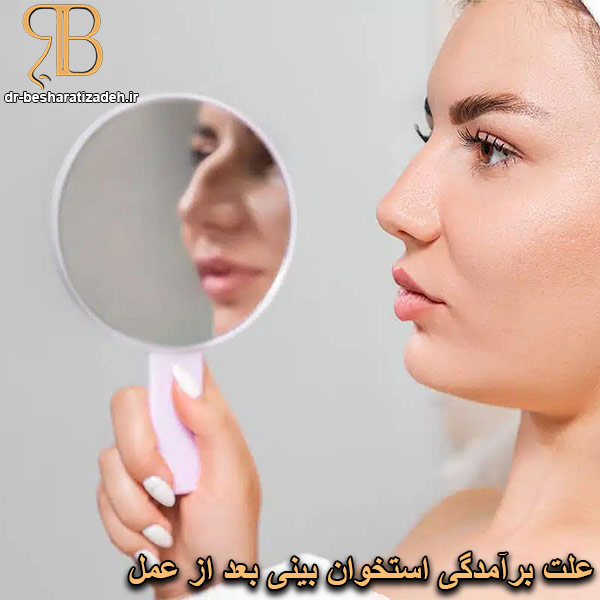 برآمدگی استخوان بینی بعد از عمل - dr-besharatizadeh.ir