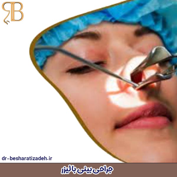 جراحی بینی با لیزر