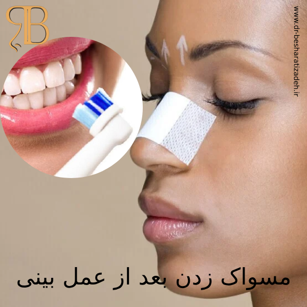 مسواک بعد از عمل بینی - دکتر روزینا بشارتی زاده