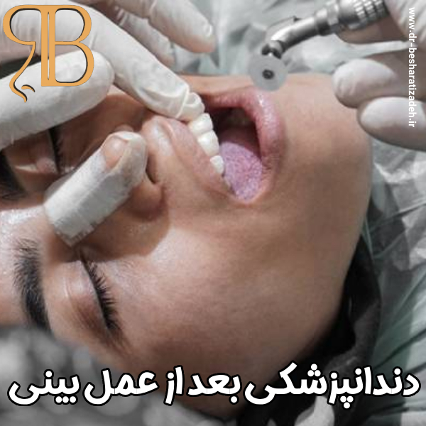 دندانپزشکی بعد از عمل بینی با دکتر روزینا بشارتی زاده در تهران